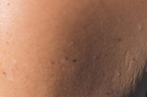 skin in the sun, close-up